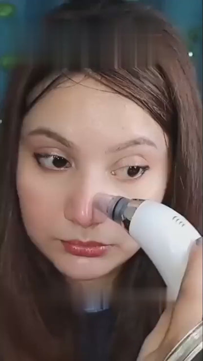 Face Vacuum Suction Blackhead Remover Pore Cleaner